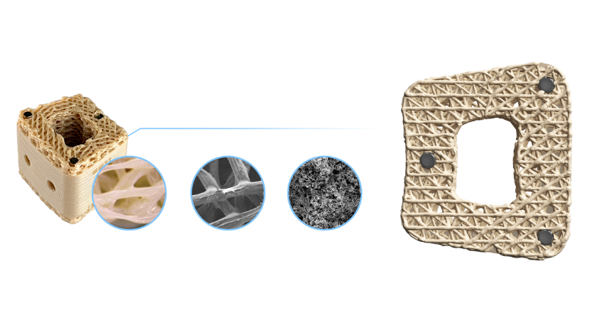 Curiteva Marks Inspire Implant Milestone